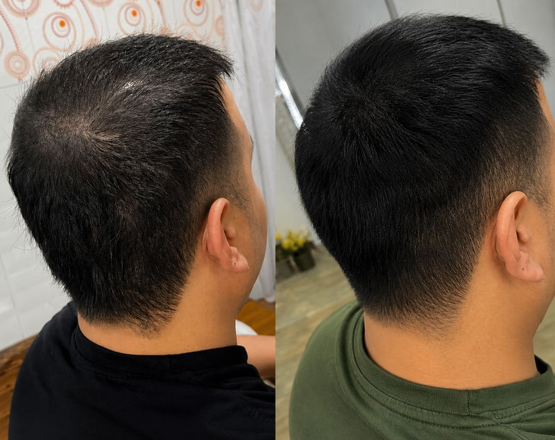 Before